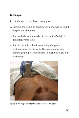 Technique

1. Use the curved or phased array probe.

2. Increase the depth as needed. The aorta will be found
   deep in the abdomen.

3. Start with the probe marker to the patient s right to
   get a transverse view.

4. Start in the subxyphoid space using the probe
   position shown in Figure 2. The sonographer may
   need to gently press downward to push bowel gas out
   of the way.




Figure 2. Probe position for transverse view of the aorta


                                                            246
 