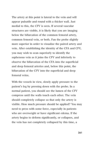 The artery at this point is lateral to the vein and will
appear pulsatile and round with a thicker wall. Just
medial to this, the CFV is seen. If several vascular
structures are visible, it is likely that you are imaging
below the bifurcation of the common femoral artery,
common femoral vein, or both. Fan the probe slightly
more superior in order to visualize the paired artery and
vein. After establishing the identity of the CFA and CFV,
you may wish to scan superiorly to identify the
saphenous vein as it joins the CFV and inferiorly to
observe the bifurcation of the CFA into the superﬁcial
and deep femoral arteries and, below this point, the
bifurcation of the CFV into the superﬁcial and deep
femoral veins.

With the vessels in view, slowly apply pressure to the
patient s leg by pressing down with the probe. In a
normal patient, you should see the lumen of the CFV
compress until the walls touch each other. The vein
should completely collapse so that only the artery is
visible. How much pressure should be applied? You may
need to press with some force, especially in patients
who are overweight or have signiﬁcant edema. If the
artery begins to deform signiﬁcantly, or collapses, and
the vein has not completely collapsed by this time, a


                                                            261
 