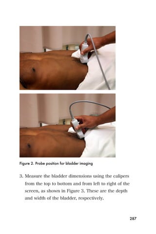 Figure 2. Probe position for bladder imaging


3. Measure the bladder dimensions using the calipers
   from the top to bottom and from left to right of the
   screen, as shown in Figure 3. These are the depth
   and width of the bladder, respectively.



                                                          287
 