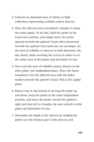 3. Look for an abnormal area of edema or ﬂuid
  collection, representing cellulitis and/or abscess.

4. Once the aﬀected area is localized, visualize it along
  the entire plane. To do this, hold the probe in the
  transverse position, and simply move the probe
  upward towards the patient s head, then downward
  towards the patient s feet until you can no longer see
  the area of cellulitis or abscess in both directions. Do
  this slowly while watching the screen in order to see
  the entire area in this plane and determine its size.

5. Now scan the area of cellulitis and/or abscess in the
  other plane, the longitudinal plane. Place the linear
  transducer over the aﬀected area with the index
  marker towards the patient s head. This is the sagital
  plane.

6. Repeat step 4, but instead of moving the probe up
  and down, keep the probe in the same longitudinal
  position, and move the probe toward the patient s
  right and then left to visualize the area entirely in this
  plane and determine its size.

7. Determine the depth of the abscess by holding the
  probe over the deepest part of the abscess and



                                                          300
 