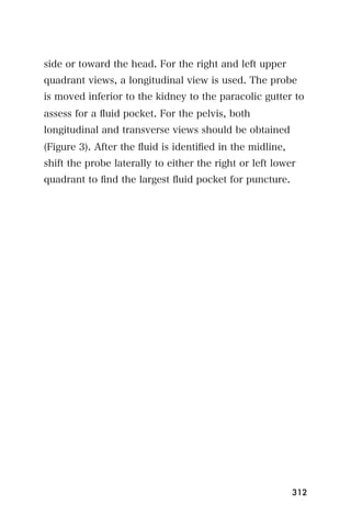 side or toward the head. For the right and left upper
quadrant views, a longitudinal view is used. The probe
is moved inferior to the kidney to the paracolic gutter to
assess for a ﬂuid pocket. For the pelvis, both
longitudinal and transverse views should be obtained
(Figure 3). After the ﬂuid is identiﬁed in the midline,
shift the probe laterally to either the right or left lower
quadrant to ﬁnd the largest ﬂuid pocket for puncture.




                                                          312
 