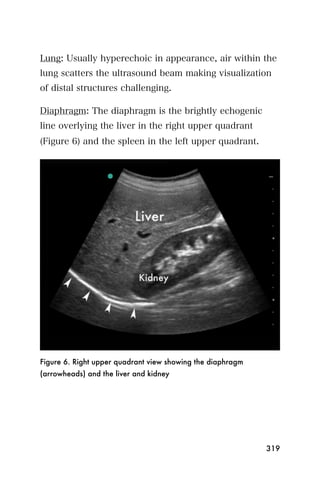Lung: Usually hyperechoic in appearance, air within the
lung scatters the ultrasound beam making visualization
of distal structures challenging.

Diaphragm: The diaphragm is the brightly echogenic
line overlying the liver in the right upper quadrant
(Figure 6) and the spleen in the left upper quadrant.




Figure 6. Right upper quadrant view showing the diaphragm
(arrowheads) and the liver and kidney




                                                            319
 