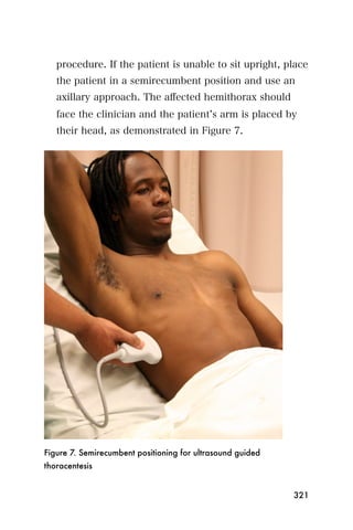 procedure. If the patient is unable to sit upright, place
   the patient in a semirecumbent position and use an
   axillary approach. The aﬀected hemithorax should
   face the clinician and the patient s arm is placed by
   their head, as demonstrated in Figure 7.




Figure 7. Semirecumbent positioning for ultrasound guided
thoracentesis


                                                            321
 