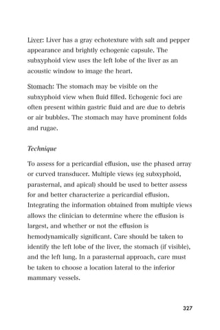 Liver: Liver has a gray echotexture with salt and pepper
appearance and brightly echogenic capsule. The
subxyphoid view uses the left lobe of the liver as an
acoustic window to image the heart.

Stomach: The stomach may be visible on the
subxyphoid view when ﬂuid ﬁlled. Echogenic foci are
often present within gastric ﬂuid and are due to debris
or air bubbles. The stomach may have prominent folds
and rugae.


Technique

To assess for a pericardial eﬀusion, use the phased array
or curved transducer. Multiple views (eg subxyphoid,
parasternal, and apical) should be used to better assess
for and better characterize a pericardial eﬀusion.
Integrating the information obtained from multiple views
allows the clinician to determine where the eﬀusion is
largest, and whether or not the eﬀusion is
hemodynamically signiﬁcant. Care should be taken to
identify the left lobe of the liver, the stomach (if visible),
and the left lung. In a parasternal approach, care must
be taken to choose a location lateral to the inferior
mammary vessels.



                                                           327
 
