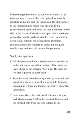 Ultrasound guidance may be static or dynamic. If the
static approach is used, then the optimal location for
puncture is marked and the depth from the skin surface
to the pericardium is noted. The distance to the
pericardium is estimated using the depth markers on the
side of the screen. If the dynamic approach is used, the
pericardiocentesis needle is visualized as it penetrates
down to and through the pericardium. Real-time
guidance allows the clinician to assess for adequate
needle entry and to avoid myocardial puncture.


Step by step approach

1. Ask the patient to lie in a semirecumbent position or
  in the left lateral decubitus position. This brings the
  heart closer to the anterior chest wall. The patient s
  left arm is placed by their head.

2. Scan the heart from the subxyphoid, parasternal, and
  apical views to determine if a pericardial eﬀusion is
  present and if there are ﬁndings suggestive of cardiac
  tamponade.

3. Determine where the pericardial eﬀusion is largest
  and which approach oﬀers the shortest distance and
  the clearest path from the skin surface to the



                                                         328
 