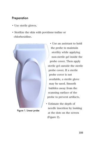 Preparation

• Use sterile gloves.

• Sterilize the skin with povidone-iodine or
 chlorhexidine.

                                • Use an assistant to hold
                                 the probe to maintain
                                 sterility while applying
                                 non-sterile gel inside the
                                probe cover. Then apply
                              sterile gel outside the sterile
                               probe cover. If a sterile
                               probe cover is not
                               available, a sterile glove
                               may be used. Smooth
                               bubbles away from the
                              scanning surface of the
                              probe to prevent artifacts.

                             • Estimate the depth of
                              needle insertion by looking
    Figure 1. Linear probe
                              at the dots on the screen
                              (Figure 2).




                                                           335
 