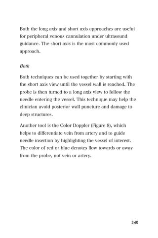 Both the long axis and short axis approaches are useful
for peripheral venous cannulation under ultrasound
guidance. The short axis is the most commonly used
approach.


Both

Both techniques can be used together by starting with
the short axis view until the vessel wall is reached. The
probe is then turned to a long axis view to follow the
needle entering the vessel. This technique may help the
clinician avoid posterior wall puncture and damage to
deep structures.

Another tool is the Color Doppler (Figure 8), which
helps to diﬀerentiate vein from artery and to guide
needle insertion by highlighting the vessel of interest.
The color of red or blue denotes ﬂow towards or away
from the probe, not vein or artery.




                                                           340
 