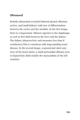 Ultrasound

Bedside ultrasound revealed bilateral pleural eﬀusions,
ascites, and small kidneys with loss of diﬀerentiation
between the cortex and the medulla. In the ﬁrst image,
there is a hypoechoic eﬀusion superior to the diaphragm
as well as free ﬂuid between the liver and the kidney.
The kidney ishyperechoic and measures less than 8
centimeters.This is consistent with long-standing renal
disease. In the second image, a parasternal short axis
view of the heart shows a small pericardial eﬀusion seen
as hypoechoic ﬂuid outside the myocardium of the left
ventricle.




                                                         366
 