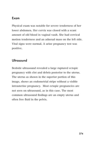 Exam

Physical exam was notable for severe tenderness of her
lower abdomen. Her cervix was closed with a scant
amount of old blood in vaginal vault. She had cervical
motion tenderness and an adnexal mass on the left side.
Vital signs were normal. A urine pregnancy test was
positive.



Ultrasound

Bedside ultrasound revealed a large ruptured ectopic
pregnancy with clot and debris posterior to the uterus.
The uterus as shown in the superior portion of this
image, shows an endometrial stripe without a visible
intrauterine pregnancy. Most ectopic pregnancies are
not seen on ultrasound, as in this case. The most
common ultrasound ﬁndings are an empty uterus and
often free ﬂuid in the pelvis.




                                                       374
 