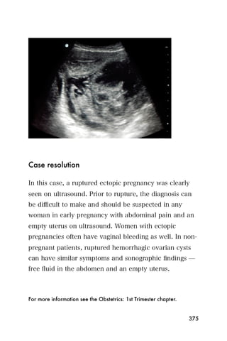 Case resolution

In this case, a ruptured ectopic pregnancy was clearly
seen on ultrasound. Prior to rupture, the diagnosis can
be diﬃcult to make and should be suspected in any
woman in early pregnancy with abdominal pain and an
empty uterus on ultrasound. Women with ectopic
pregnancies often have vaginal bleeding as well. In non-
pregnant patients, ruptured hemorrhagic ovarian cysts
can have similar symptoms and sonographic ﬁndings ̶
free ﬂuid in the abdomen and an empty uterus.



For more information see the Obstetrics: 1st Trimester chapter.


                                                                  375
 