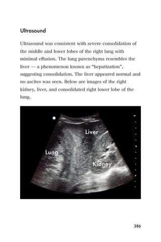 Ultrasound

Ultrasound was consistent with severe consolidation of
the middle and lower lobes of the right lung with
minimal eﬀusion. The lung parenchyma resembles the
liver ̶ a phenomenon known as hepatization ,
suggesting consolidation. The liver appeared normal and
no ascites was seen. Below are images of the right
kidney, liver, and consolidated right lower lobe of the
lung.




                                                          386
 