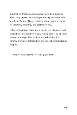 minimal obstruction, children may also be diagnosed
when they present later with pulmonary overcirculation
and heart failure. These children often exhibit dyspnea
on exertion, clubbing, and erythrocytosis.

Echocardiography plays a key role in the diagnosis and
evaluation for operative repair, which almost all of these
patients undergo. This patient was scheduled for
surgery. For more information see the Echocardiography
chapter.



For more information see the Echocardiography chapter.




                                                         406
 