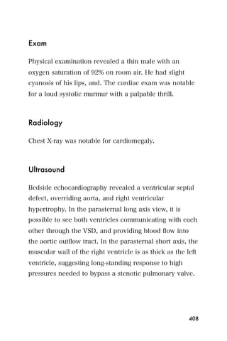 Exam

Physical examination revealed a thin male with an
oxygen saturation of 92% on room air. He had slight
cyanosis of his lips, and. The cardiac exam was notable
for a loud systolic murmur with a palpable thrill.



Radiology

Chest X-ray was notable for cardiomegaly.



Ultrasound

Bedside echocardiography revealed a ventricular septal
defect, overriding aorta, and right ventricular
hypertrophy. In the parasternal long axis view, it is
possible to see both ventricles communicating with each
other through the VSD, and providing blood ﬂow into
the aortic outﬂow tract. In the parasternal short axis, the
muscular wall of the right ventricle is as thick as the left
ventricle, suggesting long-standing response to high
pressures needed to bypass a stenotic pulmonary valve.




                                                         408
 