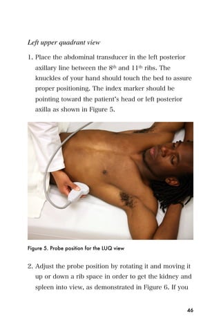 Left upper quadrant view

1. Place the abdominal transducer in the left posterior
   axillary line between the 8th and 11th ribs. The
   knuckles of your hand should touch the bed to assure
   proper positioning. The index marker should be
   pointing toward the patient s head or left posterior
   axilla as shown in Figure 5.




Figure 5. Probe position for the LUQ view


2. Adjust the probe position by rotating it and moving it
   up or down a rib space in order to get the kidney and
   spleen into view, as demonstrated in Figure 6. If you


                                                          46
 