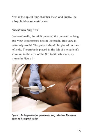 Next is the apical four chamber view, and ﬁnally, the
subxyphoid or subcostal view.


Parasternal long axis

Conventionally, for adult patients, the parasternal long
axis view is performed ﬁrst in the exam. This view is
extremely useful. The patient should be placed on their
left side. The probe is placed to the left of the patient s
sternum, in the area of the 3rd to 5th rib space, as
shown in Figure 1.




Figure 1. Probe position for parasternal long axis view. The arrow
points to the right shoulder




                                                                     77
 