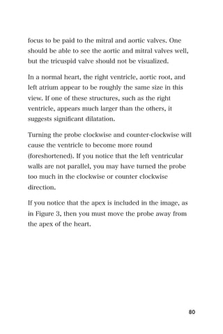 focus to be paid to the mitral and aortic valves. One
should be able to see the aortic and mitral valves well,
but the tricuspid valve should not be visualized.

In a normal heart, the right ventricle, aortic root, and
left atrium appear to be roughly the same size in this
view. If one of these structures, such as the right
ventricle, appears much larger than the others, it
suggests signiﬁcant dilatation.

Turning the probe clockwise and counter-clockwise will
cause the ventricle to become more round
(foreshortened). If you notice that the left ventricular
walls are not parallel, you may have turned the probe
too much in the clockwise or counter clockwise
direction.

If you notice that the apex is included in the image, as
in Figure 3, then you must move the probe away from
the apex of the heart.




                                                           80
 
