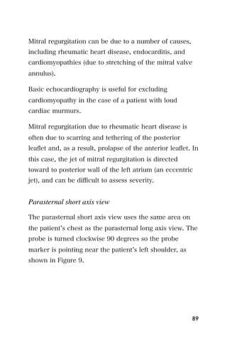 Mitral regurgitation can be due to a number of causes,
including rheumatic heart disease, endocarditis, and
cardiomyopathies (due to stretching of the mitral valve
annulus).

Basic echocardiography is useful for excluding
cardiomyopathy in the case of a patient with loud
cardiac murmurs.

Mitral regurgitation due to rheumatic heart disease is
often due to scarring and tethering of the posterior
leaﬂet and, as a result, prolapse of the anterior leaﬂet. In
this case, the jet of mitral regurgitation is directed
toward to posterior wall of the left atrium (an eccentric
jet), and can be diﬃcult to assess severity.


Parasternal short axis view

The parasternal short axis view uses the same area on
the patient s chest as the parasternal long axis view. The
probe is turned clockwise 90 degrees so the probe
marker is pointing near the patient s left shoulder, as
shown in Figure 9.




                                                          89
 