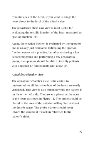 from the apex of the heart, if you want to image the
heart closer to the level of the mitral valve.

The parasternal short axis view is most useful for
evaluating the systolic function of the heart measured as
ejection fraction (EF).

Again, the ejection fraction is evaluated by the operator
and is usually just estimated. Estimating the ejection
fraction comes with practice, but after reviewing a few
echocardiograms and performing a few echocardio-
grams, the operator should be able to identify patients
with a normal EF and patients with a low EF.


Apical four chamber view

The apical four chamber view is the easiest to
understand, as all four chambers of the heart are easily
visualized. This view is also obtained while the patient is
on his or her left side. The probe is placed at the apex
of the heart as shown in Figure 11. The probe should be
placed in the area of the anterior axillary line at about
the 5th rib space. The probe marker should point
toward the ground (3 o clock in reference to the
patient s side).




                                                            92
 
