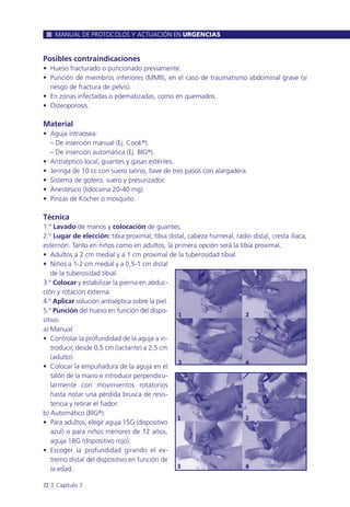 Posibles contraindicaciones
• Hueso fracturado o puncionado previamente.
• Punción de miembros inferiores (MMII), en el caso de traumatismo abdominal grave (si
riesgo de fractura de pelvis).
• En zonas infectadas o edematizadas, como en quemados.
• Osteoporosis.
Material
• Aguja intraósea:
– De inserción manual (Ej. Cook®).
– De inserción automática (Ej. BIG®).
• Antiséptico local, guantes y gasas estériles.
• Jeringa de 10 cc con suero salino, llave de tres pasos con alargadera.
• Sistema de gotero, suero y presurizador.
• Anestésico (lidocaína 20-40 mg).
• Pinzas de Kocher o mosquito.
Técnica
1.º Lavado de manos y colocación de guantes.
2.º Lugar de elección: tibia proximal, tibia distal, cabeza humeral, radio distal, cresta ilíaca,
esternón. Tanto en niños como en adultos, la primera opción será la tibia proximal,
• Adultos a 2 cm medial y a 1 cm proximal de la tuberosidad tibial.
• Niños a 1-2 cm medial y a 0,5-1 cm distal
de la tuberosidad tibial.
3.º Colocar y estabilizar la pierna en abduc-
ción y rotación externa.
4.º Aplicar solución antiséptica sobre la piel.
5.º Punción del hueso en función del dispo-
sitivo:
a) Manual:
• Controlar la profundidad de la aguja a in-
troducir, desde 0,5 cm (lactante) a 2,5 cm
(adulto).
• Colocar la empuñadura de la aguja en el
talón de la mano e introducir perpendicu-
larmente con movimientos rotatorios
hasta notar una pérdida brusca de resis-
tencia y retirar el fiador.
b) Automático (BIG®):
• Para adultos, elegir aguja 15G (dispositivo
azul) o para niños menores de 12 años,
aguja 18G (dispositivo rojo).
• Escoger la profundidad girando el ex-
tremo distal del dispositivo en función de
la edad.
MANUAL DE PROTOCOLOS Y ACTUACIÓN EN URGENCIAS
72 l Capítulo 7
 