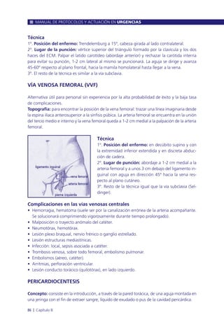 Técnica
1º. Posición del enfermo: Trendelemburg a 15º, cabeza girada al lado contralateral.
2º. Lugar de la punción: vértice superior del triángulo formado por la clavícula y los dos
haces del ECM. Palpar el latido carotídeo (abordaje anterior) y rechazar la carótida interna
para evitar su punción, 1-2 cm lateral al mismo se puncionará. La aguja se dirige y avanza
45-60º respecto al plano frontal, hacia la mamila homolateral hasta llegar a la vena.
3º. El resto de la técnica es similar a la vía subclavia.
VÍA VENOSA FEMORAL (VVF)
Alternativa útil para personal sin experiencia por la alta probabilidad de éxito y la baja tasa
de complicaciones.
Topografía: para encontrar la posición de la vena femoral: trazar una línea imaginaria desde
la espina ilíaca anterosuperior a la sínfisis púbica. La arteria femoral se encuentra en la unión
del tercio medio e interno y la vena femoral queda a 1-2 cm medial a la palpación de la arteria
femoral.
Técnica
1º. Posición del enfermo: en decúbito supino y con
la extremidad inferior extendida y en discreta abduc-
ción de cadera.
2º. Lugar de punción: abordaje a 1-2 cm medial a la
arteria femoral y a unos 3 cm debajo del ligamento in-
guinal con aguja en dirección 45º hacia la vena res-
pecto al plano cutáneo.
3º. Resto de la técnica igual que la vía subclavia (Sel-
dinger).
Complicaciones en las vías venosas centrales
• Hemorragia, hematoma (suele ser por la canalización errónea de la arteria acompañante.
Se solucionará comprimiendo vigorosamente durante tiempo prolongado).
• Malposición o trayecto anómalo del catéter.
• Neumotórax, hemotórax.
• Lesión plexo braquial, nervio frénico o ganglio estrellado.
• Lesión estructuras mediastínicas.
• Infección: local, sepsis asociada a catéter.
• Trombosis venosa, sobre todo femoral, embolismo pulmonar.
• Embolismos (aéreo, catéter).
• Arritmias, perforación ventricular.
• Lesión conducto torácico (quilotórax), en lado izquierdo.
PERICARDIOCENTESIS
Concepto: consiste en la introducción, a través de la pared torácica, de una aguja montada en
una jeringa con el fin de extraer sangre, líquido de exudado o pus de la cavidad pericárdica.
MANUAL DE PROTOCOLOS Y ACTUACIÓN EN URGENCIAS
86 l Capítulo 8
 