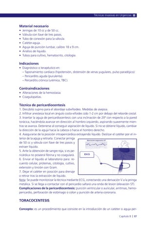 Material necesario
• Jeringas de 10 cc y de 50 cc.
• Válvula con llave de tres pasos.
• Tubo de conexión para la válvula.
• Catéter-aguja.
• Aguja de punción lumbar, calibre 18 x 9 cm.
• Análisis de líquido.
• Tubos para cultivo, hematocrito, citología.
Indicaciones
• Diagnóstico o terapéutico en:
– Taponamiento cardiaco (hipotensión, distensión de venas yugulares, pulso paradójico).
– Pericarditis aguda (purulenta).
– Percarditis crónica (urémica, TBC).
Contraindicaciones
• Alteraciones de la hemostasia.
• Coagulopatías.
Técnica de pericardiocentesis
1. Decúbito supino para el abordaje subxifoideo. Medidas de asepsia.
2. Infiltrar anestesia local en ángulo costo-xifoides izdo 1-2 cm por debajo del reborde costal.
3. Insertar la aguja de pericardiocentesis con una inclinación de 20º con respecto a la pared
torácica, haciéndola avanzar en dirección al hombro izquierdo, aspirando suavemente mien-
tras se avanza. Detenerse al conseguir aspiración de líquido. Si no se obtiene líquido, cambiar
la dirección de la aguja hacia la cabeza o hacia el hombro derecho.
4. Asegurarse de la posición intrapericárdica extrayendo líquido. Deslizar el catéter por el in-
terior de la aguja y retirarla. Conectar jeringa
de 50 cc y válvula con llave de tres pasos y
extraer líquido.
5. Ante la obtención de sangre roja, si es pe-
ricárdica no poseerá fibrina y no coagulará.
6. Enviar el líquido al laboratorio para: re-
cuento celular, proteínas, citología, cultivo,
extensión y tinción con Gram.
7. Dejar el catéter en posición para drenaje
o retirar tras la extracción de líquido.
Nota: Se puede monitorizar la técnica mediante ECG, conectando una derivación V a la jeringa
metálica. Si se llega a contactar con el pericardio saltará una onda de lesion (elevación ST).
Complicaciones de la pericardiocentesis: punción ventricular o auricular, arritmias, hemo-
pericardio, perforación de estómago o colon y punción de arteria coronaria.
TORACOCENTESIS
Concepto: es un procedimiento que consiste en la introducción de un catéter o aguja per-
Técnicas invasivas en Urgencias
Capítulo 8 l 87
 