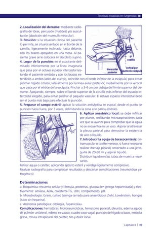 2. Localización del derrame: mediante radio-
grafía de tórax, percusión (matidez) y/o auscul-
tación (abolición del murmullo vesicular).
3. Posición: si la situación clínica del paciente
lo permite, se situará sentado en el borde de la
camilla, ligeramente inclinado hacia delante,
con los brazos apoyados en una mesa. Al pa-
ciente grave se le colocará en decúbito supino.
4. Lugar de la punción: en el cuadrante deli-
mitado inferiormente por la línea imaginaria
que pasa por el octavo espacio intercostal (es-
tando el paciente sentado y con los brazos ex-
tendidos a ambos lados del cuerpo, coincide con el borde inferior de la escápula) para evitar
pinchar hígado o bazo; lateralmente por la línea axilar posterior; medialmente por la vertical
que pasa por el vértice de la escápula. Pinchar a 3-4 cm por debajo del límite superior del de-
rrame. Apoyando, siempre, sobre el borde superior de la costilla más inferior del espacio in-
tercostal elegido, para evitar pinchar el paquete vascular. El octavo espacio intercostal debe
ser el punto más bajo para efectuar la punción.
5. Preparar el campo estéril: aplicar la solución antiséptica en espiral, desde el punto de
punción hacia fuera, por 3 veces, delimitando la zona con paños estériles.
6. Aplicar anestésico local: se debe infiltrar
por planos, realizando microaspiraciones cada
vez que se avanza para comprobar que la aguja
no se encuentra en un vaso. Aspirar al atravesar
la pleura parietal para demostrar la existencia
de aire o líquido.
7. Introducir la aguja de toracocentesis: (in-
tramuscular o catéter venoso; si fuera necesario
realizar drenaje pleural) conectado a una jerin-
guilla de 20-50 ml y aspirar líquido.
Distribuir líquido en los tubos de muestra nece-
sarios.
Retirar aguja o catéter, aplicando apósito estéril y vendaje ligeramente compresivo.
Realizar radiografía para comprobar resultados y descartar complicaciones (neumotórax ya-
trogénico).
Determinaciones
a. Bioquímica: recuento celular y fórmula, proteínas, glucosa (en jeringa heparinizada) y elec-
tivamente: amilasa, ADA, colesterol-TG, LDH, complemento, pH.
b. Microbiología: Gram, cultivo (jeringa cerrada para anaerobios), Ziehl, Lowënstein, hongos
(tubo sin heparina).
c. Anatomía patológica: citología, Papanicolau.
Complicaciones: hemotórax, hidroneumotórax, hematoma parietal, pleuritis, edema agudo
de pulmón unilateral, edema ex-vacuo, cuadro vaso-vagal, punción de hígado o bazo, embolia
grasa, rotura intrapleural del catéter, tos y dolor local.
Técnicas invasivas en Urgencias
Capítulo 8 l 89
 