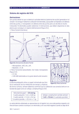 Sistema de registro del ECG
Derivaciones
Son puntos desde los que se detecta la actividad eléctrica (potencial de acción) generada en el
corazón. Se consigue mediante la utilización de electrodos, que pueden ser bipolares si la detecta
entre dos puntos, o monopolares si la detecta entre dos puntos pero uno de ellos es neutro.
Colocando 10 electrodos pueden obtenerse 12 derivaciones, que deben disponerse en dos
planos para conseguir un registro bidimensional (Figura 9.2).
1. Plano frontal (miembros)
– Monopolares: aVR, aVL, aVF.
– Bipolares: I, II, III.
2. Plano horizontal (precordiales). Son todas monopolares
(Figura 9.3).
– V1-V6.
– V3R-V6R (electrodos en la parte derecha del corazón).
Registro
El electrocardiógrafo utiliza un papel milimetrado que faci-
lita la realización de las mediciones de tiempo y amplitud.
De forma rutinaria, siempre debemos confirmar que la calibración sea correcta tanto en ve-
locidad de papel como en voltaje o amplitud (Figura 9.4):
Velocidad de papel Æ 25 mm/sg
Cuadro pequeño 1 mm = 0,04 sg Voltaje o amplitud (en sentido vertical)
Cuadro grande Æ 5 mm = 0,2 sg 1 mV = 10 mm (2 cuadrados grandes)
5 cuadros grandes Æ 25 mm = 1 sg
La señal eléctrica detectada se representará en el registro con una onda positiva respecto a la
línea de base cuando se acerque a un electrodo y con una onda negativa cuando se aleje de él.
MANUAL DE PROTOCOLOS Y ACTUACIÓN EN URGENCIAS
100 l Capítulo 9
Figura 9.2. Derivaciones del plano frontal.
Figura 9.3. Plano horizontal.
 