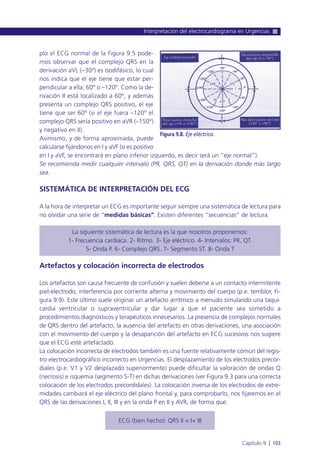 plo el ECG normal de la Figura 9.5 pode-
mos observar que el complejo QRS en la
derivación aVL (–30º) es isodifásico, lo cual
nos indica que el eje tiene que estar per-
pendicular a ella: 60º o –120º. Como la de-
rivación II está localizado a 60º, y además
presenta un complejo QRS positivo, el eje
tiene que ser 60º (si el eje fuera –120º el
complejo QRS sería positivo en aVR (–150º)
y negativo en II).
Asimismo, y de forma aproximada, puede
calcularse fijándonos en I y aVF (si es positivo
en I y aVF, se encontrará en plano inferior izquierdo, es decir será un “eje normal”).
Se recomienda medir cualquier intervalo (PR, QRS, QT) en la derivación donde más largo
sea.
SISTEMÁTICA DE INTERPRETACIÓN DEL ECG
A la hora de interpretar un ECG es importante seguir siempre una sistemática de lectura para
no olvidar una serie de “medidas básicas”. Existen diferentes “secuencias” de lectura.
La siguiente sistemática de lectura es la que nosotros proponemos:
1- Frecuencia cardiaca. 2- Ritmo. 3- Eje eléctrico. 4- Intervalos: PR, QT.
5- Onda P. 6- Complejo QRS. 7- Segmento ST. 8- Onda T
Artefactos y colocación incorrecta de electrodos
Los artefactos son causa frecuente de confusión y suelen deberse a un contacto intermitente
piel-electrodo, interferencia por corriente alterna y movimiento del cuerpo (p.e. temblor, Fi-
gura 9.9). Este último suele originar un artefacto arrítmico a menudo simulando una taqui-
cardia ventricular o supraventricular y dar lugar a que el paciente sea sometido a
procedimientos diagnósticos y terapéuticos innecesarios. La presencia de complejos normales
de QRS dentro del artefacto, la ausencia del artefacto en otras derivaciones, una asociación
con el movimiento del cuerpo y la desaparición del artefacto en ECG sucesivos nos sugiere
que el ECG esté artefactado.
La colocación incorrecta de electrodos también es una fuente relativamente común del regis-
tro electrocardiográfico incorrecto en Urgencias. El desplazamiento de los electrodos precor-
diales (p.e. V1 y V2 desplazado superiormente) puede dificultar la valoración de ondas Q
(necrosis) e isquemia (segmento S-T) en dichas derivaciones (ver Figura 9.3 para una correcta
colocación de los electrodos precordidales). La colocación inversa de los electrodos de extre-
midades cambiará el eje eléctrico del plano frontal y, para comprobarlo, nos fijaremos en el
QRS de las derivaciones I, II, III y en la onda P en II y AVR, de forma que:
ECG (bien hecho): QRS II = I+ III
Interpretación del electrocardiograma en Urgencias
Capítulo 9 l 103
Figura 9.8. Eje eléctrico.
 