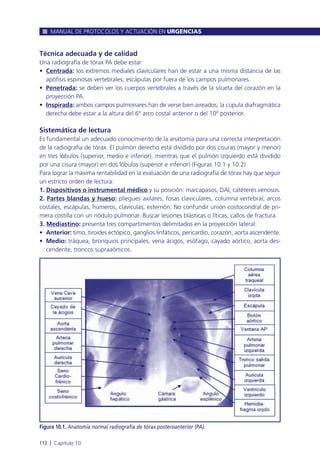 Técnica adecuada y de calidad
Una radiografía de tórax PA debe estar:
• Centrada: los extremos mediales clavículares han de estar a una misma distancia de las
apófisis espinosas vertebrales; escápulas por fuera de los campos pulmonares.
• Penetrada: se deben ver los cuerpos vertebrales a través de la silueta del corazón en la
proyección PA.
• Inspirada: ambos campos pulmonares han de verse bien aireados; la cúpula diafragmática
derecha debe estar a la altura del 6º arco costal anterior o del 10º posterior.
Sistemática de lectura
Es fundamental un adecuado conocimiento de la anatomía para una correcta interpretación
de la radiografía de tórax. El pulmón derecho está dividido por dos cisuras (mayor y menor)
en tres lóbulos (superior, medio e inferior), mientras que el pulmón izquierdo está dividido
por una cisura (mayor) en dos lóbulos (superior e inferior) (Figuras 10.1 y 10.2).
Para lograr la máxima rentabilidad en la evaluación de una radiografía de tórax hay que seguir
un estricto orden de lectura:
1. Dispositivos o instrumental médico y su posición: marcapasos, DAI, catéteres venosos.
2. Partes blandas y hueso: pliegues axilares, fosas claviculares, columna vertebral, arcos
costales, escápulas, húmeros, clavículas, esternón. No confundir unión costocondral de pri-
mera costilla con un nódulo pulmonar. Buscar lesiones blásticas o líticas, callos de fractura.
3. Mediastino: presenta tres compartimentos delimitados en la proyección lateral:
• Anterior: timo, tiroides ectópico, ganglios linfáticos, pericardio, corazón, aorta ascendente.
• Medio: tráquea, bronquios principales, vena ácigos, esófago, cayado aórtico, aorta des-
cendente, troncos supraaórticos.
MANUAL DE PROTOCOLOS Y ACTUACIÓN EN URGENCIAS
112 l Capítulo 10
Figura 10.1. Anatomía normal radiografía de tórax posteroanterior (PA).
 