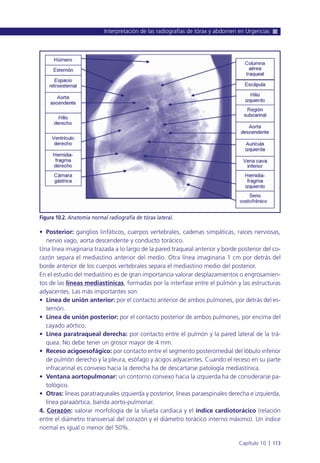 • Posterior: ganglios linfáticos, cuerpos vertebrales, cadenas simpáticas, raíces nerviosas,
nervio vago, aorta descendente y conducto torácico.
Una línea imaginaria trazada a lo largo de la pared traqueal anterior y borde posterior del co-
razón separa el mediastino anterior del medio. Otra línea imaginaria 1 cm por detrás del
borde anterior de los cuerpos vertebrales separa el mediastino medio del posterior.
En el estudio del mediastino es de gran importancia valorar desplazamientos o engrosamien-
tos de las líneas mediastínicas, formadas por la interfase entre el pulmón y las estructuras
adyacentes. Las más importantes son:
• Línea de unión anterior: por el contacto anterior de ambos pulmones, por detrás del es-
ternón.
• Línea de unión posterior: por el contacto posterior de ambos pulmones, por encima del
cayado aórtico.
• Línea paratraqueal derecha: por contacto entre el pulmón y la pared lateral de la trá-
quea. No debe tener un grosor mayor de 4 mm.
• Receso acigoesofágico: por contacto entre el segmento posteromedial del lóbulo inferior
de pulmón derecho y la pleura, esófago y ácigos adyacentes. Cuando el receso en su parte
infracarinal es convexo hacia la derecha ha de descartarse patología mediastínica.
• Ventana aortopulmonar: un contorno convexo hacia la izquierda ha de considerarse pa-
tológico.
• Otras: líneas paratraqueales izquierda y posterior, líneas paraespinales derecha e izquierda,
línea paraaórtica, banda aorto-pulmonar.
4. Corazón: valorar morfología de la silueta cardiaca y el índice cardiotorácico (relación
entre el diámetro transversal del corazón y el diámetro torácico interno máximo). Un índice
normal es igual o menor del 50%.
Interpretación de las radiografías de tórax y abdomen en Urgencias
Capítulo 10 l 113
Figura 10.2. Anatomía normal radiografía de tórax lateral.
 