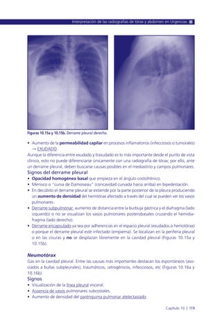 • Aumento de la permeabilidad capilar en procesos inflamatorios (infecciosos o tumorales)
Æ EXUDADO.
Aunque la diferencia entre exudado y trasudado es lo más importante desde el punto de vista
clínico, esto no puede diferenciarse únicamente con una radiografía de tórax; por ello, ante
un derrame pleural, deben buscarse causas posibles en el mediastino y campos pulmonares.
Signos del derrame pleural
• Opacidad homogénea basal que empieza en el ángulo costofrénico.
• Menisco o “curva de Damoiseau” (concavidad curvada hacia arriba) en bipedestación.
• En decúbito el derrame pleural se extiende por la parte posterior de la pleura produciendo
un aumento de densidad del hemitórax afectado a través del cual se pueden ver los vasos
pulmonares.
• Derrame subpulmonar: aumento de distancia entre la burbuja gástrica y el diafragma (lado
izquierdo) o no se visualizan los vasos pulmonares posterobasales cruzando el hemidia-
fragma (lado derecho).
• Derrame encapsulado ya sea por adherencias en el espacio pleural (exudados o hemotórax)
o porque el derrame pleural esté infectado (empiema). Se localizan en la periferia pleural
o en las cisuras y no se desplazan libremente en la cavidad pleural (Figuras 10.15a y
10.15b).
Neumotórax
Gas en la cavidad pleural. Entre las causas más importantes destacan los espontáneos (aso-
ciados a bullas subpleurales), traumáticos, iatrogénicos, infecciosos, etc (Figuras 10.16a y
10.16b).
Signos
• Visualización de la línea pleural visceral.
• Ausencia de vasos pulmonares subcostales.
• Aumento de densidad del parénquima pulmonar atelectasiado.
Interpretación de las radiografías de tórax y abdomen en Urgencias
Capítulo 10 l 119
Figuras 10.15a y 10.15b. Derrame pleural derecho.
 