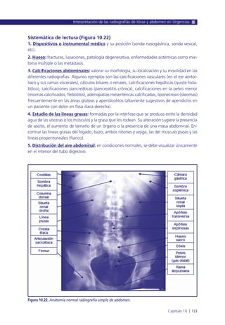 Sistemática de lectura (Figura 10.22)
1. Dispositivos o instrumental médico y su posición (sonda nasogástrica, sonda vesical,
etc).
2. Hueso: fracturas, luxaciones, patología degenerativa, enfermedades sistémicas como mie-
loma múltiple o las metástasis.
3. Calcificaciones abdominales: valorar su morfología, su localización y su movilidad en las
diferentes radiografías. Algunos ejemplos son las calcificaciones vasculares (en el eje aortoi-
líaco y sus ramas viscerales), cálculos biliares o renales, calcificaciones hepáticas (quiste hida-
tídico), calcificaciones pancreáticas (pancreatitis crónica), calcificaciones en la pelvis menor
(miomas calcificados, flebolitos), adenopatías mesentéricas calcificadas, liponecrosis (oleomas)
frecuentemente en las áreas glúteas y apendicolitos (altamente sugestivos de apendicitis en
un paciente con dolor en fosa ilíaca derecha).
4. Estudio de las líneas grasas: formadas por la interfase que se produce entre la densidad
agua de las vísceras o los músculos y la grasa que los rodean. Su alteración sugiere la presencia
de ascitis, el aumento de tamaño de un órgano o la presencia de una masa abdominal. En-
contrar las líneas grasas del hígado, bazo, ambos riñones y vejiga, las del músculo psoas y las
líneas properitoneales (flanco).
5. Distribución del aire abdominal: en condiciones normales, se debe visualizar únicamente
en el interior del tubo digestivo.
Interpretación de las radiografías de tórax y abdomen en Urgencias
Capítulo 10 l 123
Figura 10.22. Anatomía normal radiografía simple de abdomen.
 
