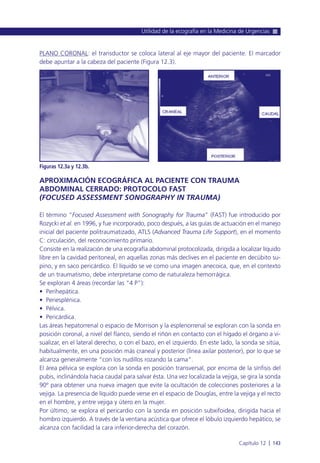 PLANO CORONAL: el transductor se coloca lateral al eje mayor del paciente. El marcador
debe apuntar a la cabeza del paciente (Figura 12.3).
APROXIMACIÓN ECOGRÁFICA AL PACIENTE CON TRAUMA
ABDOMINAL CERRADO: PROTOCOLO FAST
(FOCUSED ASSESSMENT SONOGRAPHY IN TRAUMA)
El término “Focused Assessment with Sonography for Trauma” (FAST) fue introducido por
Rozycki et al. en 1996, y fue incorporado, poco después, a las guías de actuación en el manejo
inicial del paciente politraumatizado, ATLS (Advanced Trauma Life Support), en el momento
C: circulación, del reconocimiento primario.
Consiste en la realización de una ecografía abdominal protocolizada, dirigida a localizar líquido
libre en la cavidad peritoneal, en aquellas zonas más declives en el paciente en decúbito su-
pino, y en saco pericárdico. El líquido se ve como una imagen anecoica, que, en el contexto
de un traumatismo, debe interpretarse como de naturaleza hemorrágica.
Se exploran 4 áreas (recordar las “4 P”):
• Perihepática.
• Periesplénica.
• Pélvica.
• Pericárdica.
Las áreas hepatorrenal o espacio de Morrison y la esplenorrenal se exploran con la sonda en
posición coronal, a nivel del flanco, siendo el riñón en contacto con el hígado el órgano a vi-
sualizar, en el lateral derecho, o con el bazo, en el izquierdo. En este lado, la sonda se sitúa,
habitualmente, en una posición más craneal y posterior (línea axilar posterior), por lo que se
alcanza generalmente “con los nudillos rozando la cama”.
El área pélvica se explora con la sonda en posición transversal, por encima de la sínfisis del
pubis, inclinándola hacia caudal para salvar ésta. Una vez localizada la vejiga, se gira la sonda
90º para obtener una nueva imagen que evite la ocultación de colecciones posteriores a la
vejiga. La presencia de líquido puede verse en el espacio de Douglas, entre la vejiga y el recto
en el hombre, y entre vejiga y útero en la mujer.
Por último, se explora el pericardio con la sonda en posición subxifoidea, dirigida hacia el
hombro izquierdo. A través de la ventana acústica que ofrece el lóbulo izquierdo hepático, se
alcanza con facilidad la cara inferior-derecha del corazón.
Utilidad de la ecografía en la Medicina de Urgencias
Capítulo 12 l 143
Figuras 12.3a y 12.3b.
 