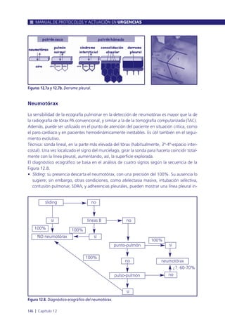 Neumotórax
La sensibilidad de la ecografía pulmonar en la detección de neumotórax es mayor que la de
la radiografía de tórax PA convencional, y similar a la de la tomografía computarizada (TAC).
Además, puede ser utilizado en el punto de atención del paciente en situación crítica, como
el paro cardiaco y en pacientes hemodinámicamente inestables. Es útil también en el segui-
miento evolutivo.
Técnica: sonda lineal, en la parte más elevada del tórax (habitualmente, 3º-4º-espacio inter-
costal). Una vez localizado el signo del murciélago, girar la sonda para hacerla coincidir total-
mente con la línea pleural, aumentando, así, la superficie explorada.
El diagnóstico ecográfico se basa en el análisis de cuatro signos según la secuencia de la
Figura 12.8.
• Sliding: su presencia descarta el neumotórax, con una precisión del 100%. Su ausencia lo
sugiere; sin embargo, otras condiciones, como atelectasia masiva, intubación selectiva,
contusión pulmonar, SDRA, y adherencias pleurales, pueden mostrar una línea pleural in-
MANUAL DE PROTOCOLOS Y ACTUACIÓN EN URGENCIAS
146 l Capítulo 12
Figuras 12.7a y 12.7b. Derrame pleural.
Figura 12.8. Diagnóstico ecográfico del neumotórax.
no
¿?: 60-70%
sliding no
líneas B no
punto-pulmón
100%
sí
neumotórax
nopulso-pulmón
sí
100%
síNO neumotórax
100%100%
sí
 