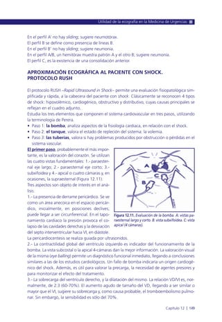 En el perfil A’ no hay sliding; sugiere neumotórax.
El perfil B se define como presencia de líneas B.
En el perfil B’ no hay sliding; sugiere neumonía.
En el perfil A/B, un hemitórax muestra patrón A y el otro B; sugiere neumonía.
El perfil C, es la existencia de una consolidación anterior.
APROXIMACIÓN ECOGRÁFICA AL PACIENTE CON SHOCK.
PROTOCOLO RUSH
El protocolo RUSH –Rapid Ultrasound in Shock– permite una evaluación fisiopatológica sim-
plificada y rápida, a la cabecera del paciente con shock. Clásicamente se reconocen 4 tipos
de shock: hipovolémico, cardiogénico, obstructivo y distributivo, cuyas causas principales se
reflejan en el cuadro adjunto.
Estudia los tres elementos que componen el sistema cardiovascular en tres pasos, utilizando
la terminología de Perera.
• Paso 1: la bomba, analiza aspectos de la fisiología cardiaca, en relación con el shock.
• Paso 2: el tanque, valora el estado de repleción del sistema: la volemia.
• Paso 3: las tuberías, valora si hay problemas producidos por obstrucción o pérdidas en el
sistema vascular.
El primer paso, probablemente el más impor-
tante, es la valoración del corazón. Se utilizan
las cuatro vistas fundamentales: 1.- paraester-
nal eje largo; 2.- paraesternal eje corto; 3.-
subxifoidea y 4.- apical o cuatro cámaras y, en
ocasiones, la supraesternal (Figura 12.11).
Tres aspectos son objeto de interés en el aná-
lisis:
1.- La presencia de derrame pericárdico. Se ve
como un área anecoica en el espacio pericár-
dico, inicialmente, en posiciones declives;
puede llegar a ser circunferencial. En el tapo-
namiento cardiaco la presión provoca el co-
lapso de las cavidades derechas y la desviación
del septo interventricular hacia VI, en diástole.
La pericardiocentesis se realiza guiada por ultrasonidos.
2.- La contractilidad global del ventrículo izquierdo es indicador del funcionamiento de la
bomba. La vista subcostal o la apical 4-cámaras dan la mejor información. La valoración visual
de la misma (eye balling) permite un diagnóstico funcional inmediato, llegando a conclusiones
similares a las de los estudios cardiológicos. Un fallo de bomba indicaría un origen cardiogé-
nico del shock. Además, es útil para valorar la precarga, la necesidad de agentes presores y
para monitorizar el efecto del tratamiento.
3.- La sobrecarga del ventrículo derecho, y la dilatación del mismo. La relación VD/VI es, nor-
malmente, de 2:3 (60-70%). El aumento agudo de tamaño del VD, llegando a ser similar o
mayor que el VI, sugiere su sobrecarga y, como causa probable, el tromboembolismo pulmo-
nar. Sin embargo, la sensibilidad es sólo del 70%.
Utilidad de la ecografía en la Medicina de Urgencias
Capítulo 12 l 149
Figura 12.11. Evaluación de la bomba. A: vistas pa-
raesternal largo y corto. B: vista subxifoidea. C: vista
apical (4 cámaras).
 