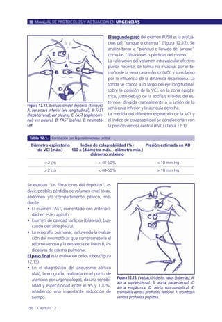 El segundo paso del examen RUSH es la evalua-
ción del “tanque o cisterna” (Figura 12.12). Se
analiza tanto la “plenitud o llenado del tanque”
como las “filtraciones o pérdidas del mismo”.
La valoración del volumen intravascular efectivo
puede hacerse, de forma no invasiva, por el ta-
maño de la vena cava inferior (VCI) y su colapso
por la influencia de la dinámica respiratoria. La
sonda se coloca a lo largo del eje longitudinal,
sobre la posición de la VCI, en la zona epigás-
trica, justo debajo de la apófisis xifoides del es-
ternón, dirigida cranealmente a la unión de la
vena cava inferior y la aurícula derecha.
La medida del diámetro espiratorio de la VCI y
el índice de colapsabilidad se correlacionan con
la presión venosa central (PVC) (Tabla 12.1):
Se evalúan “las filtraciones del depósito”, es
decir, posibles pérdidas de volumen en el tórax,
abdomen y/o compartimento pélvico, me-
diante:
• El examen FAST, comentado con anteriori-
dad en este capítulo.
• Examen de cavidad torácica (bilateral), bus-
cando derrame pleural.
• La ecografía pulmonar, incluyendo la evalua-
ción del neumotórax que comprometería el
retorno venoso y la existencia de líneas B, in-
dicativas de edema pulmonar.
El paso final es la evaluación de los tubos (Figura
12.13):
• En el diagnóstico del aneurisma aórtico
(AA), la ecografía, realizada en el punto de
atención por urgenciólogos, da una sensibi-
lidad y especificidad entre el 95 y 100%,
añadiendo una importante reducción de
tiempo.
MANUAL DE PROTOCOLOS Y ACTUACIÓN EN URGENCIAS
150 l Capítulo 12
Figura 12.12. Evaluación del depósito (tanque).
A: vena cava inferior (eje longitudinal). B: FAST
(hepatorrenal; ver pleura). C: FAST (esplenorre-
nal; ver pleura). D: FAST (pelvis). E: neumotó-
rax.
Figura 12.13. Evaluación de los vasos (tuberías). A:
aorta supraesternal. B: aorta paraesternal. C:
aorta epigástrica. D: aorta supraumbilical. E:
trombosis venosa profunda femoral. F: trombosis
venosa profunda poplítea.
Diámetro espiratorio Índice de colapsabilidad (%) Presión estimada en AD
de VCI (máx.) 100 x (diámetro máx. - diámetro mín.)
diámetro máximo
< 2 cm > 40-50% < 10 mm Hg
> 2 cm < 40-50% > 10 mm Hg
Tabla 12.1. Correlación con la presión venosa central
 