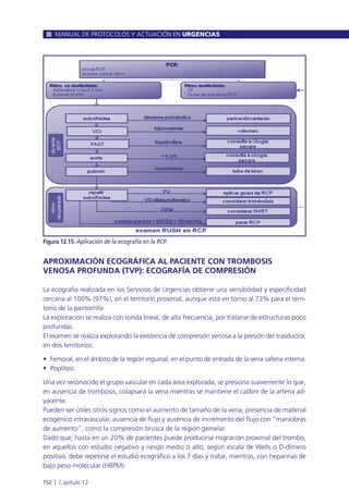 MANUAL DE PROTOCOLOS Y ACTUACIÓN EN URGENCIAS
152 l Capítulo 12
Figura 12.15. Aplicación de la ecografía en la RCP.
APROXIMACIÓN ECOGRÁFICA AL PACIENTE CON TROMBOSIS
VENOSA PROFUNDA (TVP): ECOGRAFÍA DE COMPRESIÓN
La ecografía realizada en los Servicios de Urgencias obtiene una sensibilidad y especificidad
cercana al 100% (97%), en el territorio proximal, aunque está en torno al 73% para el terri-
torio de la pantorrilla.
La exploración se realiza con sonda lineal, de alta frecuencia, por tratarse de estructuras poco
profundas.
El examen se realiza explorando la existencia de compresión venosa a la presión del trasductor,
en dos territorios:
• Femoral, en el ámbito de la región inguinal, en el punto de entrada de la vena safena interna.
• Poplíteo.
Una vez reconocido el grupo vascular en cada área explorada, se presiona suavemente lo que,
en ausencia de trombosis, colapsará la vena mientras se mantiene el calibre de la arteria ad-
yacente.
Pueden ser útiles otros signos como el aumento de tamaño de la vena, presencia de material
ecogénico intravascular, ausencia de flujo y ausencia de incremento del flujo con “maniobras
de aumento”, como la compresión brusca de la región gemelar.
Dado que, hasta en un 20% de pacientes puede producirse migración proximal del trombo,
en aquellos con estudio negativo y riesgo medio o alto, según escala de Wells o D-dímero
positivo, debe repetirse el estudio ecográfico a los 7 días y tratar, mientras, con heparinas de
bajo peso molecular (HBPM).
 