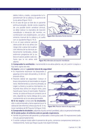 dedos índice y medio, consiguiendo la hi-
perextensión de la cabeza y la apertura de
la vía aérea (Figura 14.2).
• En el caso de que se trate de un paciente
politraumatizado, donde exista sospecha
de una posible lesión vertebral cervical,
se debe realizar la maniobra de tracción
mandibular o elevación del mentón, en
combinación con estabilización, con aline-
amiento manual de la cabeza y el cuello
con un ayudante (Figura 14.3).
• Si en el caso anterior persiste
obstrucción de la vía aérea con
riesgo vital, a pesar de la aplica-
ción efectiva de las técnicas an-
teriormente nombradas, añada
extensión progresiva de la ca-
beza en pocos grados cada vez,
hasta que la vía aérea esté
abierta.
3. Compruebe la ventilación, manteniendo la vía aérea abierta: ver, oír y sentir si respira o
hay otros signos de vida.
Si respira: valorar la posición lateral de seguridad.
• Es importante reconocer las boqueadas o
gasping como signo de parada y no de res-
piración eficaz.
• Posición lateral de seguridad. Colocar el
brazo más próximo al reanimador en ángulo
recto. Manteniendo su columna alineada, se
cogen su brazo y su pierna más lejanos, co-
locando ésta última en ángulo recto, para
hacerle girar hacia el reanimador. Posterior-
mente, se coloca el brazo en contacto con el
otro, dejando las manos debajo de su cara,
manteniendo así la vía aérea permeable.
B) Si no respira: compruebe la circulación,
sólo si está entrenado y tiene experiencia en la
valoración de enfermos críticos (punto 4). Si no,
inicie maniobras de RCP (punto 5) (Figura 14.4).
4. Compruebe la circulación, palpando el pulso central (carotídeo), sólo si es personal entrenado.
A) Si existe pulso: el enfermo está en parada respiratoria.
• Ventile los pulmones del paciente y compruebe si tiene pulso cada 10 respiraciones (cada
minuto aproximadamente).
• Si existe cualquier duda sobre la presencia de pulso, comience compresiones torácicas in-
mediatamente, hasta que llegue ayuda más experimentada.
Soporte vital. Actuación en Urgencias
Capítulo 14 l 165
Figura 14.2. Maniobra frente-mentón.
Figura 14.4. Posición lateral de seguridad.
Figura 14.3. Maniobra de tracción mandibular.
 