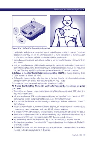 carilla, colocando la parte más estrecha en la pirámide nasal, sujetando con los 2 primeros
dedos la mascarilla y con los tres últimos dedos de la mano traccione de la mandíbula; con
la otra mano insuflaremos el aire a través del balón autohinchable.
• La intubación orotraqueal sólo debería realizarse por personal entrenado y competente en
esta técnica.
• Una vez que el paciente está intubado, continúe las compresiones torácicas ininterrumpi-
damente (excepto para las desfibrilaciones y las comprobaciones de pulso), a una frecuencia
de 100-120/min y ventile los pulmones aproximadamente a 10 respiraciones/min.
6. Coloque el monitor/desfibrilador semiautomático (DESA) en cuanto disponga de él.
El DESA realizará el análisis del ritmo.
• Coloque las palas o parches adhesivos bajo la clavícula derecha y en el costado izquierdo,
en la posición V6 en la línea medioaxilar (Figuras 14.7a y 14.7b).
En función del ritmo encontrado existen dos situaciones posibles:
A) Ritmos desfibrilables: fibrilación ventricular/taquicardia ventricular sin pulso
(FV/TVSP)
• Administrar un choque: en un desfibrilador monofásico la energía es de 360 Julios (J) o
150-200 J si es bifásico.
• Iniciar maniobras de RCP inmediatamente después, sin reevaluar pulso. Secuencia 30/2,
comenzando con las compresiones torácicas. A los 2 minutos reevaluar:
• Si el ritmo es desfibrilable, se dará una segunda descarga: 360 J en monofásico, 150-200
J en bifásicos.
• Iniciar las maniobras de RCP inmediatamente después, sin reevaluar pulso. Secuencia 30/2,
comenzando con compresiones torácicas. A los 2 minutos reevaluar:
• Si persiste FV/TVSP, administre una tercera descarga (monofásicos 360 J; bifásicos 150-360 J).
• Reinicie las compresiones torácicas inmediatamente y luego administre adrenalina 1 mg iv
y amiodarona 300 mg iv mientras se realiza RCP durante otros 2 minutos.
• Posteriormente administre adrenalina 1 mg iv cada 3-5 minutos o en ciclos alternos.
• Repita esta secuencia de 2 minutos de RCP – comprobación de ritmo/pulso – desfibrilación
si la FV/TV persiste.
• En la FV/TVSP refractaria a las descargas se puede administrar una nueva dosis de amioda-
rona de 150 mg iv después de la 4ª descarga.
Soporte vital. Actuación en Urgencias
Capítulo 14 l 167
Figuras 14.7a y 14.7b. DESA. Colocación de los parches.
 