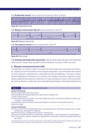 1.1. Bradicardia sinusal: ritmo sinusal con frecuencia inferior a 60 lpm:
1.2. Bloqueo sinoauricular (tipo II): pausa equivalente a dos P-P:
1.3. Paro (pausa) sinusal: pausa no equivalente a dos P-P:
1.4. Síndrome de bradicardia-taquicardia: alternancia de bradicardia (por enfermedad del
nodo sinusal) y taquicardias supraventriculares (fibrilación auricular y flutter auricular).
2. Bloqueo aurículoventricular (AV)
Corresponde a un retraso o fallo en la conducción del impulso de las aurículas a los ventrícu-
los. Aparece de forma transitoria como respuesta exagerada a una estimulación del sistema
nervioso autónomo o permanente, si existe daño estructural establecido. Con base a criterios
electrocardiográficos el bloqueo AV se clasifica como bloqueo de primer, segundo o tercer
grado y, dependiendo del punto anatómico en el que se produce el trastorno de la activación
del estímulo eléctrico, se describe como intranodal (suprahisiano) o infranodal (intrahisiano o
Atención de las arritmias en Urgencias
Capítulo 24 l 263
Figura 24.1. Bradicardia sinusal.
Figura 24.2. Bloqueo sinoauricular.
Figura 24.3. Paro sinusal.
Causas intrínsecas
Proceso degenerativo del nodo sinusal.
Miocardiopatía de etiología isquémica, hipertensiva, idiopática etc.
Cirugía cardiaca previa.
Procesos infecciosos (miocarditis viral, enfermedad de Lyme) e inflamatorios (fiebre reumática, pe-
ricarditis y conectivopatías).
Enfermedades neuromusculares (ataxia de Friedreich y distrofia muscular de Duchenne).
Hipertonía vagal.
Causas extrínsecas
Fármacos antiarrítmicos (betabloqueantes, calcioantagonistas, flecainida, procainamida, sotalol,
amiodarona, dronedarona, digoxina).
Psicofármacos (litio, antidepresivos tricíclicos, fenotiacinas).
Alteraciones hidroelectrolíticas y metabólicas: hiperpotasemia, hipermagnesemia, hipotiroidismo.
Otros: traumatismo, hipoxia, hipotermia, hipertensión intracraneal, síndrome de apnea obstructiva
del sueño.
Cabe destacar que muchos otros fármacos aparte de los mencionados en la tabla pueden producir bradiarritmias por lo que
se recomienda siempre estudiar los efectos secundarios de cada medicamento del paciente.
Tabla 24.1. Etiología de la enfermedad del nodo sinusal
 