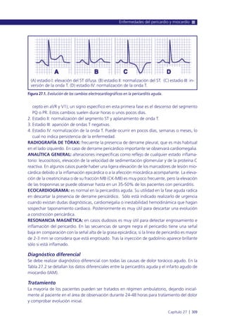 cepto en aVR y V1); un signo específico en esta primera fase es el descenso del segmento
PQ o PR. Estos cambios suelen durar horas o unos pocos días.
2. Estadio II: normalización del segmento ST y aplanamiento de onda T.
3. Estadio III: aparición de ondas T negativas.
4. Estadio IV: normalización de la onda T. Puede ocurrir en pocos días, semanas o meses, lo
cual no indica persistencia de la enfermedad.
RADIOGRAFÍA DE TÓRAX: frecuente la presencia de derrame pleural, que es más habitual
en el lado izquierdo. En caso de derrame pericárdico importante se observará cardiomegalia.
ANALÍTICA GENERAL: alteraciones inespecíficas como reflejo de cualquier estado inflama-
torio: leucocitosis, elevación de la velocidad de sedimentación glomerular y de la proteína C
reactiva. En algunos casos puede haber una ligera elevación de los marcadores de lesión mio-
cárdica debido a la inflamación epicárdica o a la afección miocárdica acompañante. La eleva-
ción de la creatincinasa o de su fracción MB (CK-MB) es muy poco frecuente, pero la elevación
de las troponinas se puede observar hasta en un 35-50% de los pacientes con pericarditis.
ECOCARDIOGRAMA: es normal en la pericarditis aguda. Su utilidad en la fase aguda radica
en descartar la presencia de derrame pericárdico. Sólo está indicado realizarlo de urgencia
cuando existan dudas diagnósticas, cardiomegalia o inestabilidad hemodinámica que hagan
sospechar taponamiento cardiaco. Posteriormente es muy útil para descartar una evolución
a constricción pericárdica.
RESONANCIA MAGNÉTICA: en casos dudosos es muy útil para detectar engrosamiento e
inflamación del pericardio. En las secuencias de sangre negra el pericardio tiene una señal
baja en comparación con la señal alta de la grasa epicárdica; si la línea de pericardio es mayor
de 2-3 mm se considera que está engrosado. Tras la inyección de gadolinio aparece brillante
sólo si está inflamado.
Diagnóstico diferencial
Se debe realizar diagnóstico diferencial con todas las causas de dolor torácico agudo. En la
Tabla 27.2 se detallan los datos diferenciales entre la pericarditis aguda y el infarto agudo de
miocardio (IAM).
Tratamiento
La mayoría de los pacientes pueden ser tratados en régimen ambulatorio, dejando inicial-
mente al paciente en el área de observación durante 24-48 horas para tratamiento del dolor
y comprobar evolución inicial.
Enfermedades del pericardio y miocardio
Capítulo 27 l 309
Figura 27.1. Evolución de los cambios electrocardiográficos en la pericarditis aguda.
(A) estadio I: elevación del ST difusa. (B) estadio II: normalización del ST. (C) estadio III: in-
versión de la onda T. (D) estadio IV: normalización de la onda T.
 