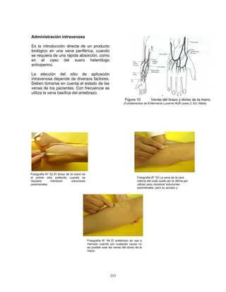 253
Administración intravenosa
Es la introducción directa de un producto
biológico en una vena periférica, cuando
se requiera de una rápida absorción, como
en el caso del suero heterólogo
antiviperino.
La elección del sitio de aplicación
intravenosa depende de diversos factores.
Deben tomarse en cuenta el estado de las
venas de los pacientes. Con frecuencia se
utiliza la vena basílica del antebrazo.
F
Figura 10 Venas del brazo y dorso de la mano.
(Fundamentos de Enfermería Luverne Wolf Lewis 2. Ed. Harla)
Fotografía N° 52 El dorso de la mano es
el primer sitio preferido cuando se
requiere introducir soluciones
parenterales.
Fotografía N° 53 La vena de la cara
interna del codo suele ser la última por
utilizar para canalizar soluciones
parenterales, pero su acceso y
Fotografía N° 54 El antebrazo se usa a
menudo cuando por cualquier causa no
es posible usar las venas del dorso de la
mano.
 