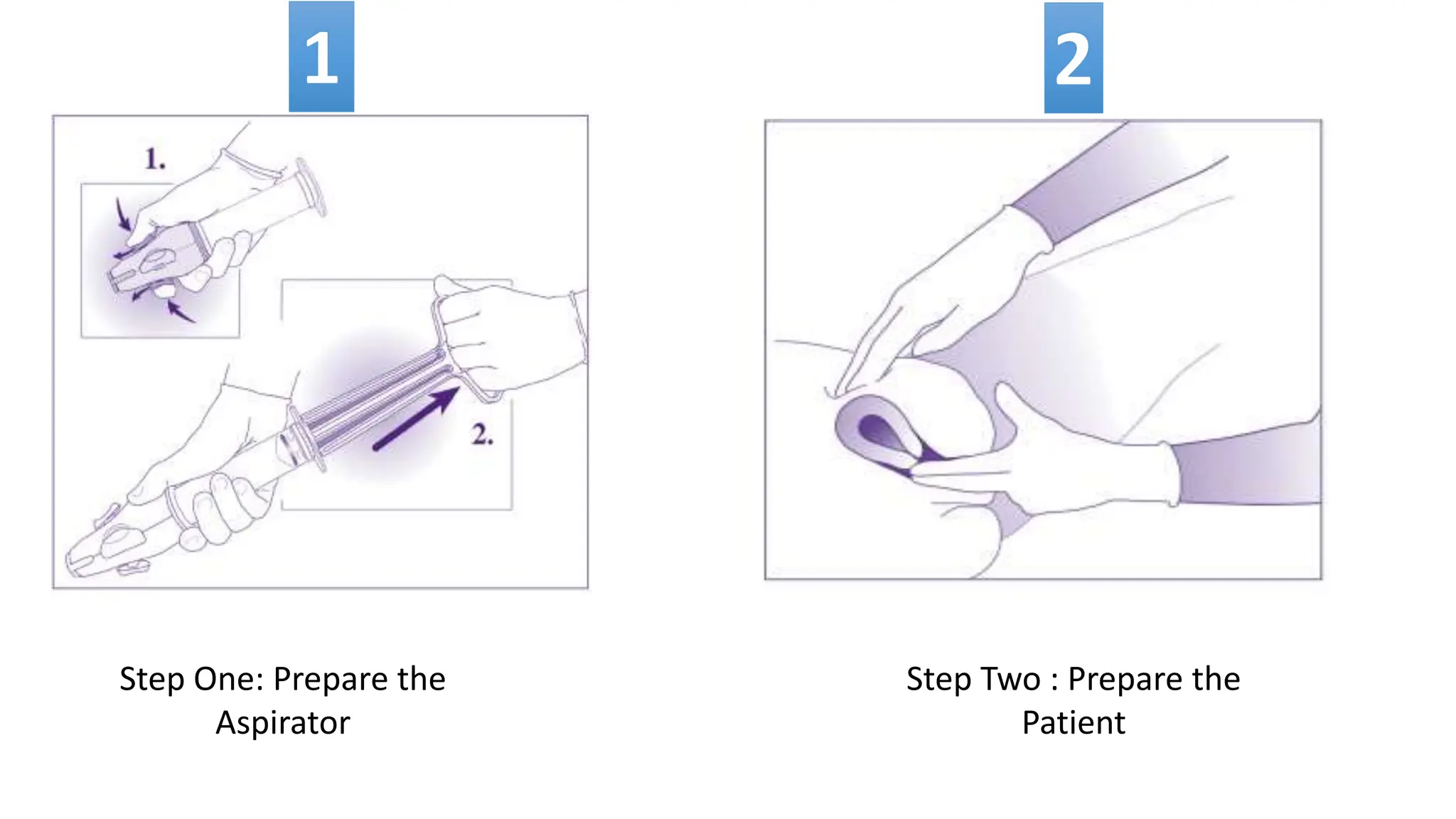 Step One: Prepare the
Aspirator
Step Two : Prepare the
Patient
 
