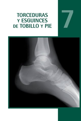 MANUAL VALORACION AJUSTE 99-152:Maquetación 1   22/12/10   10:19   Página 21




                TORCEDURAS
                 Y ESGUINCES
               DE TOBILLO Y PIE                                                7
 
