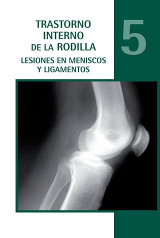 MANUAL VALORACION AJUSTE 53-98:Maquetación 1   22/12/10   10:08   Página 33




                    TRASTORNO
                      INTERNO
                   DE LA RODILLA
            LESIONES EN MENISCOS
                Y LIGAMENTOS
                                                                              5
 