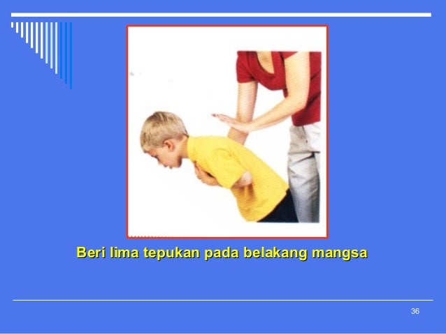 Manueve Rawatan Bantu Mula Bagi Tercekik