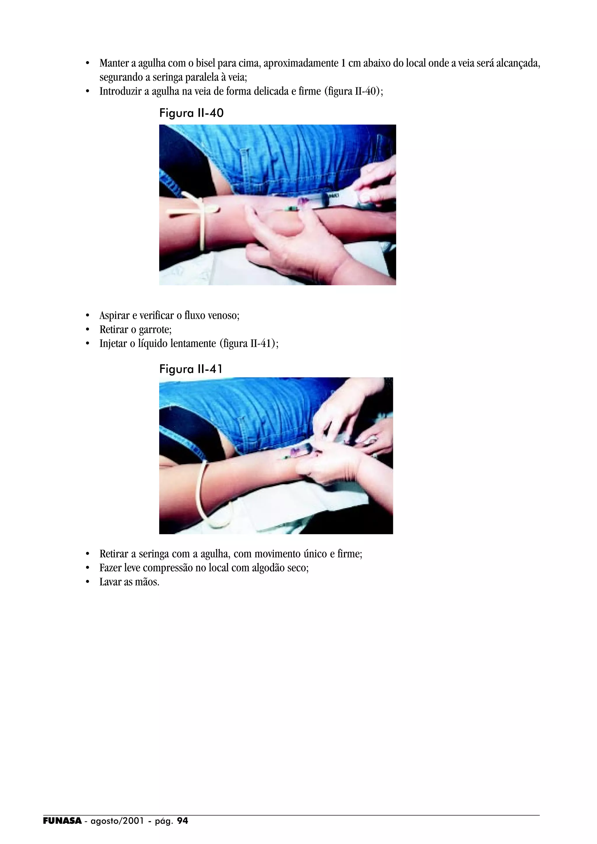 FUNASA - agosto/2001 - pág. 94
• Manter a agulha com o bisel para cima, aproximadamente 1 cm abaixo do local onde a veia será alcançada,
segurando a seringa paralela à veia;
• Introduzir a agulha na veia de forma delicada e firme (figura II-40);
• Aspirar e verificar o fluxo venoso;
• Retirar o garrote;
• Injetar o líquido lentamente (figura II-41);
• Retirar a seringa com a agulha, com movimento único e firme;
• Fazer leve compressão no local com algodão seco;
• Lavar as mãos.
Figura II-40
Figura II-41
 