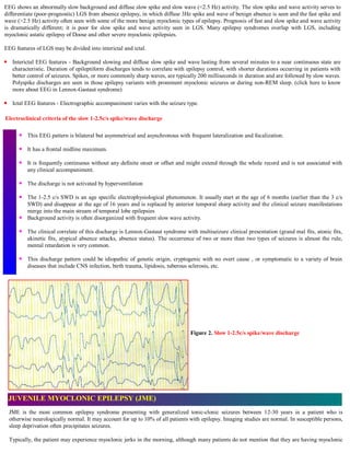 Juvenile Myoclonic Epilepsy Eeg