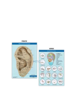 MAPA_AURICULO_SUBDIVIDIDO_POR_AREAS[1].docx