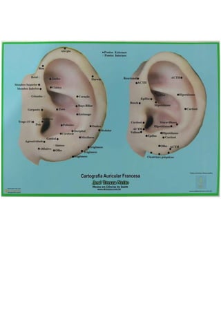 MAPA_AURICULO_SUBDIVIDIDO_POR_AREAS[1].docx